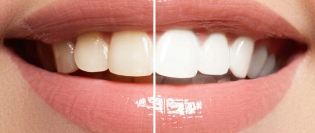 EUTHYMOL pasta do zębów bez fluoru 75 ml